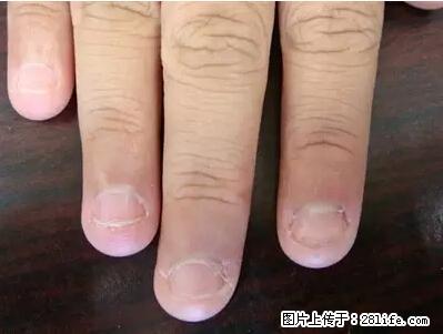 剪指甲、挖耳屎，这些日常小动作竟隐藏大危害！ - 阳泉生活资讯 - 阳泉28生活网 yq.28life.net